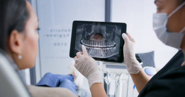Licensed Teeth Cleaning And Checkup service in Desert Hot Springs, CA - Smile Center Dentistry